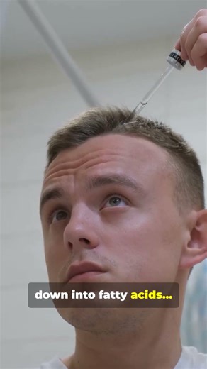 Your Hair Oil Might Be Feeding Dandruff #shorts