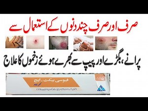 10 Benefits of Fusibact-H Cream| Fusidic Acid 2% + Hydrocortisone Acelate1% |Skin Cream|