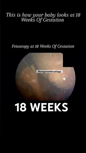The Incredible Changes Happening at 18 Weeks Gestation #PregnancyEducation #fetaldevelopment #love