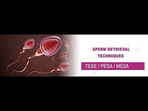 TESE SPERM PREPARATION &#icsi READY TO INJECT#icsi #maleinfertility #azoospermia