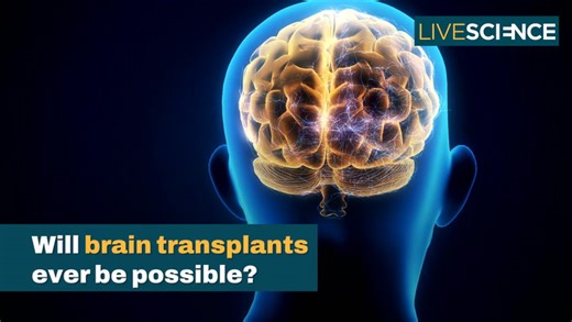 Will brain transplants ever be possible?