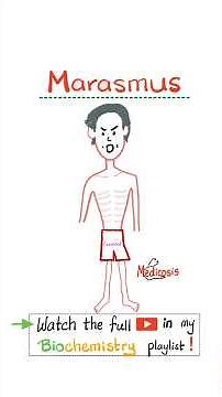 Marasmus - Total Energy Malnutrition - Gastroenterology...#diet #nutrition #health #NCLEX #USMLE