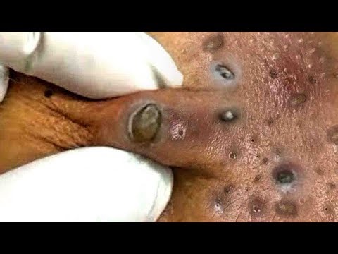 𝑅𝑒𝑐𝑙𝑎𝑖𝑚 𝑌𝑜𝑢𝑟 𝐺𝑙𝑜𝑤 𝐴𝑛𝑑 𝐶𝑎𝑙𝑚 𝑇ℎ𝑟𝑜𝑢𝑔ℎ 𝑀𝑖𝑛𝑑𝑓𝑢𝑙 𝑆𝑘𝑖𝑛𝑐𝑎𝑟𝑒 𝑀𝑜𝑚𝑒𝑛𝑡𝑠 #5759132