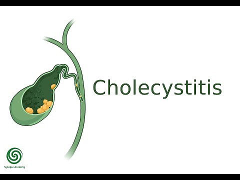 Acute Cholecystitis – Pathophysiology, Symptoms, Diagnosis & Treatment