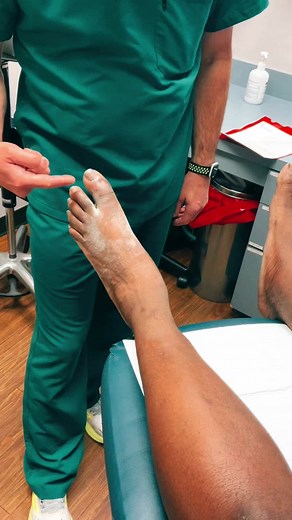 Annndd its GOUT! #podiatry #podiatrist #footdoctor #tiktokftdoc #houstontx #podiatrylife #foryoupage #fypシ #fyp #springbranchpodiatrypllc #toedoctor #gout #uricacid #elevated