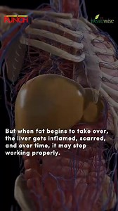 13K views · 86 reactions | The Silent Liver Epidemic: What You Need...