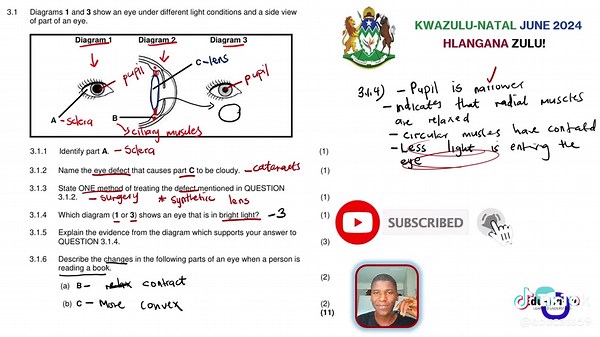 Human Eye Practice for Grade 12 Life Sciences