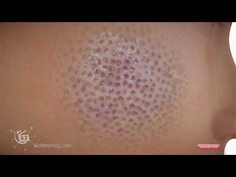 3d product animation, face cleaning medical animation