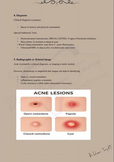 📌Case Study: Acne Vulgaris Made Easy | Causes, Myths & Treatments #viral #youtube #physiohub #fyp