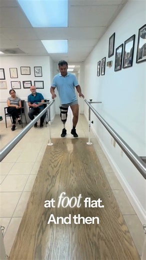 How the Pegasus Stabilizes the Knee and Improves Gait for Below-Knee Amputees