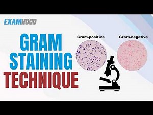 Gram Stain Technique | Principle, Steps and Interpretation