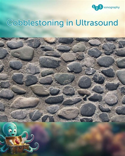 Cobblestoning – what's the reason here? 🐙