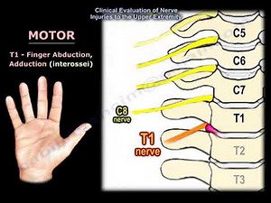 Neurological Evaluation of the Cervical Nerve Roots, Cervical Disc Herniation, Neck Pain. • Video • MEDtube.net