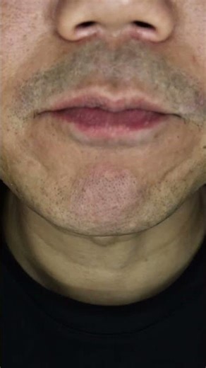 ASMR | Mini Chocolate Eggs 🍫 #DoctorTristanPeh #ASMR