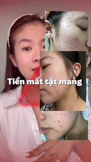 Mẹo phục hồi da với sữa rửa mặt Simple Repair