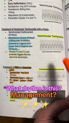 Effective Management of Ventricular Tachycardia with a Pulse