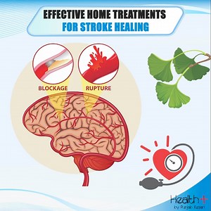5.1K views · 65 reactions | Effective Home Treatments for Stroke Healing | Health+ | Facebook