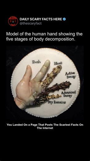 Thescaryfact ™ on Instagram: "This anatomical model of a human hand illustrates the five primary stages of body decomposition: fresh, bloat, active decay, advanced decay, and dry/remains. The visual is often used in forensic and educational settings to train students and professionals in understanding how the human body changes after death, particularly in crime scene investigations. Each stage demonstrates specific transformations — from early discoloration and swelling, to tissue breakdown and