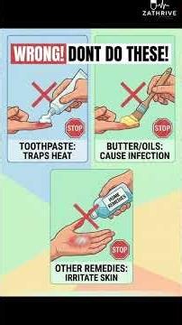 How to Treat Minor Burns at Home
