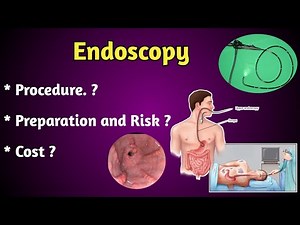 Endoscopy Test Procedure|| Cost || Risk .