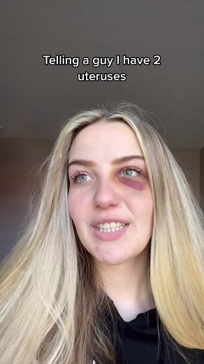 Ash on TikTok
