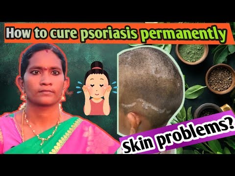 Keep a Full Stop to All Skin Problems |Skin problems in tamil Medicine | Secret of Success Case