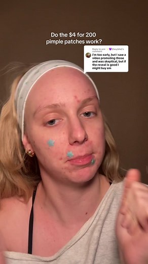 Do the $4 for 200 Pimple Patches Work?