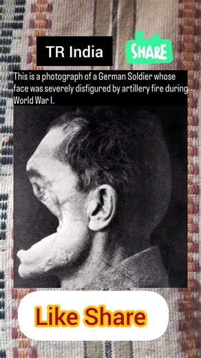 The Man Who Lost His Face: A Forgotten Hero of WWI