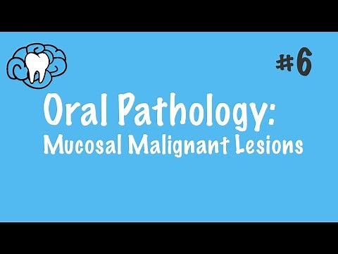 Oral Pathology | Mucosal Malignant Lesions | INBDE, ADAT