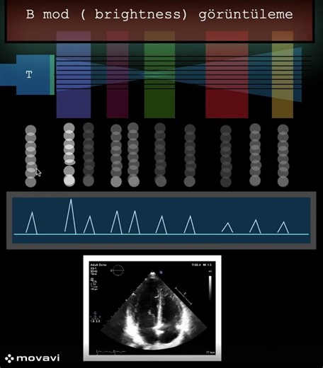 B mod ( brightness) görüntüleme