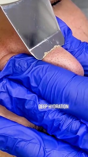 Health_Tips on Instagram: "Duniya ke ninety nine percent logo ko nahi pta . . . #healthjourney #healthbenefits #healthylifestyle #healthgoals #skinhealth #healthy"