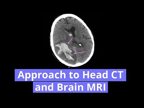 Approach to Head CT and Brain MRI