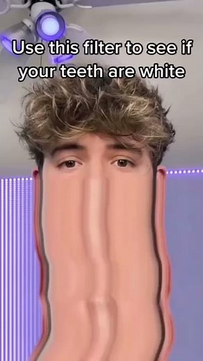 Orthodontist Reacts! The YELLOWEST Teeth in The WORLD 🌎 #shorts