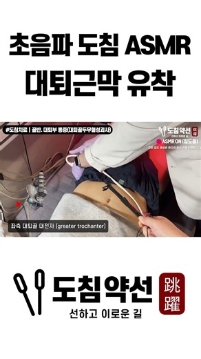 [초음파 도침 ASMR] 대퇴부 통증, 초음파 유도하 도침치료로 대퇴근막 유착 박리