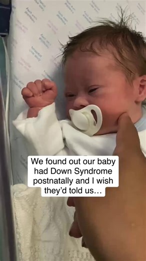2.2K views · 22 reactions | IT'S FUN FACT FRIDAY! DOWN SYNDROME...