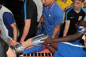 X-ray of Demba Ba's broken leg reveals extent of injury