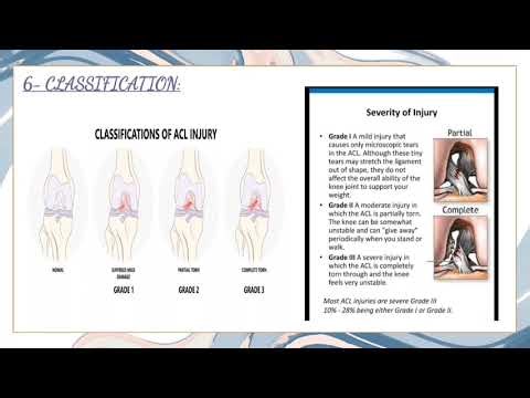 ACL INJURY OVERVIEW, PREVENTION AND IT'S MANAGEMENT