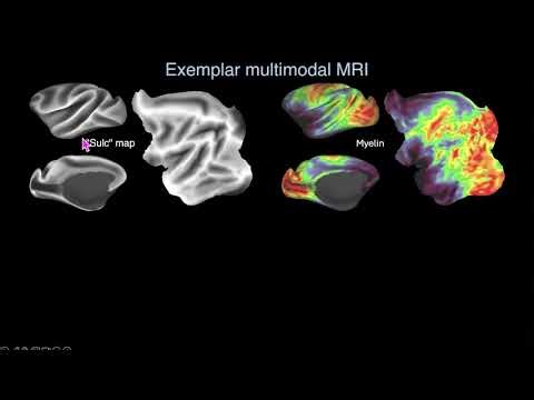Integrating single-cell multiomics & spatial transcriptomics with MRI