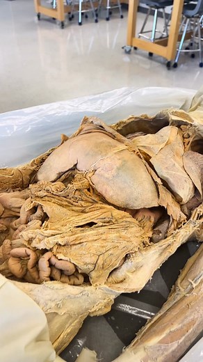 Not every cell utilizes glucose, but the vast majority do. #AnatomyClass #ScienceIsCool #Glycogen #Liver