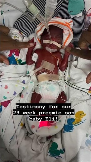 23 Tiny Preemie's Miracle: Prophet Carn's Stunning Words!