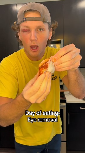 Jack Turco | Day of eating parasites have taken my eye. #wieiad #food | Instagram