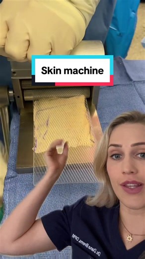 Skin Graft Machine Explained