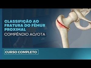 Curso AO de Fraturas do Fêmur Proximal: Como Classificar Corretamente?