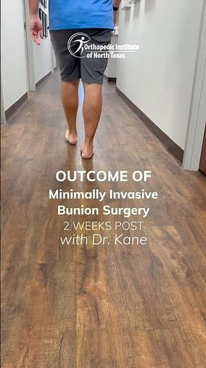 2 Weeks After Minimally Invasive Bunion Surgery at OINT #bunionsurgery