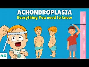 Achondroplasia – Causes, Signs and Symptoms, Diagnosis & Treatment