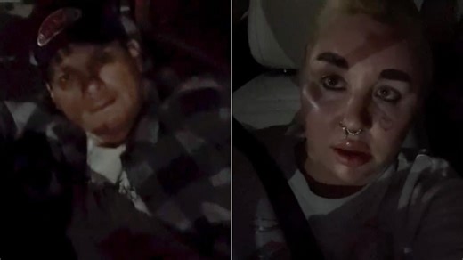 Amanda Bynes declares love to boyfriend in odd IG post