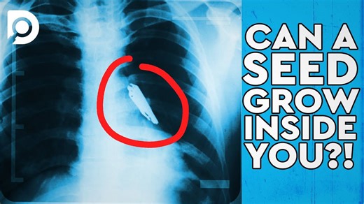 Learn what happens when food enters the wrong airway pathway