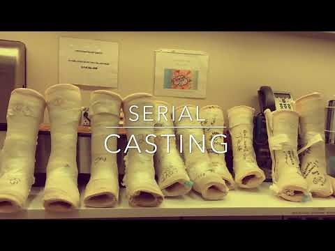 Serial Casting