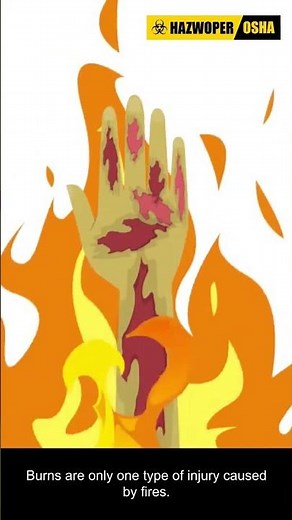 The Shocking TRUTH About Injuries Caused By Fire