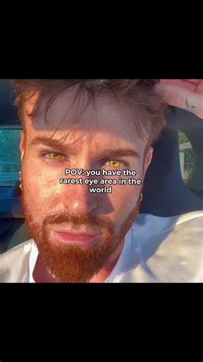 Full Facial Metrics with FaceIqLabs #looksmaxx #looks #mogging #relateable #foryoupage❤️❤️